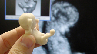 3D sonograms let blind expectant parents "see" their babies